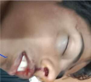 Dalit youth brutally beaten,