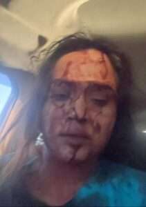 UP:महिला वेटलिफ्टर की पिटाई, लगाया छेड़छाड़ का आरोप